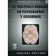 EL ENCEFALO HUMANO EN FOTOGRAFIAS Y ESQUEMAS + CD-ROM