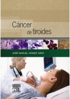 CANCER DE TIROIDES