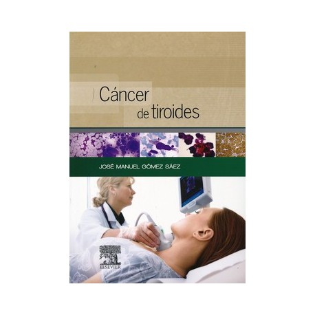 CANCER DE TIROIDES