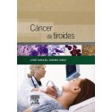 CANCER DE TIROIDES