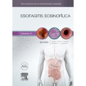 ESOFAGITIS EOSINOFILICA (CLINICAS IBEROAMERICANAS DE GASTROENTEROLOGIA Y HEPATOLOGIA VOL.5)
