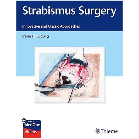 STRABISMUS SURGERY. INNOVATIVE AND CLASSIC APPROACHES