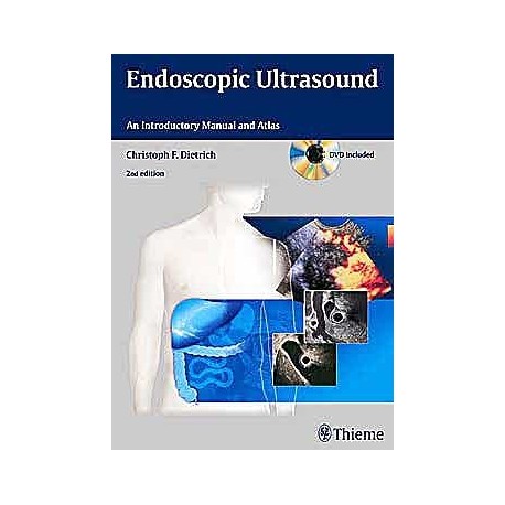 ENDOSCOPIC ULTRASOUND. AN INTRODUCTORY MANUAL AND ATLAS (DVD INCLUDED)