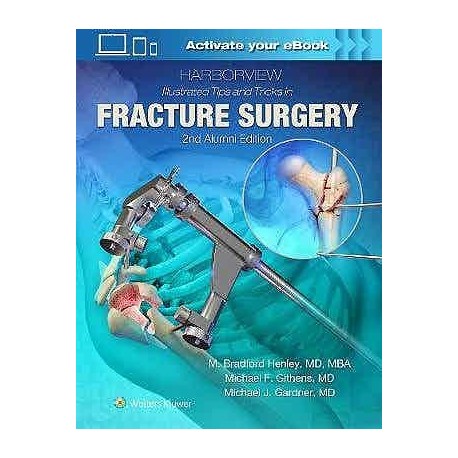 HARBORVIEW ILLUSTRATED TIPS AND TRICKS IN FRACTURE SURGERY
