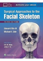 SURGICAL APPROACHES TO THE FACIAL SKELETON