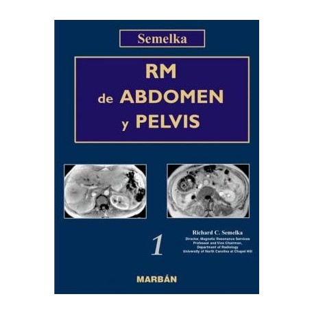 RM DE ABDOMEN Y PELVIS (2 VOL.)
