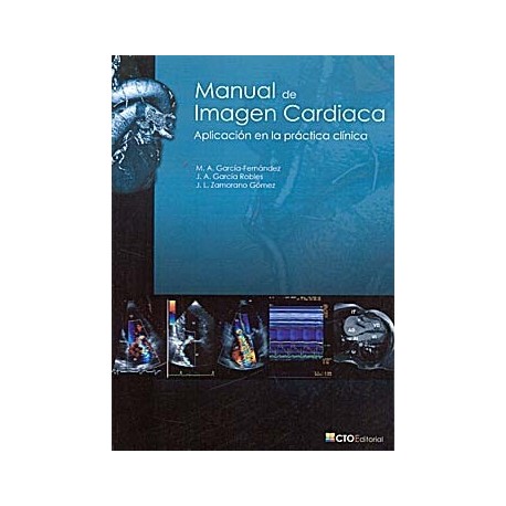 MANUAL DE IMAGEN CARDIACA. APLICACION EN LA PRACTICA CLINICA