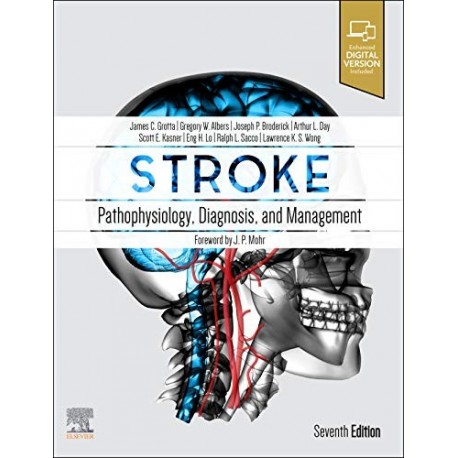 STROKE. PATHOPHYSIOLOGY, DIAGNOSIS AND MANAGEMENT (DIGITAL VERSION INCLUDED)