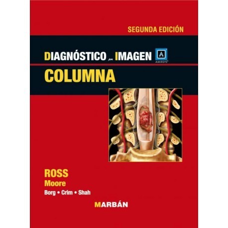 DIAGNOSTICO POR IMAGEN. COLUMNA