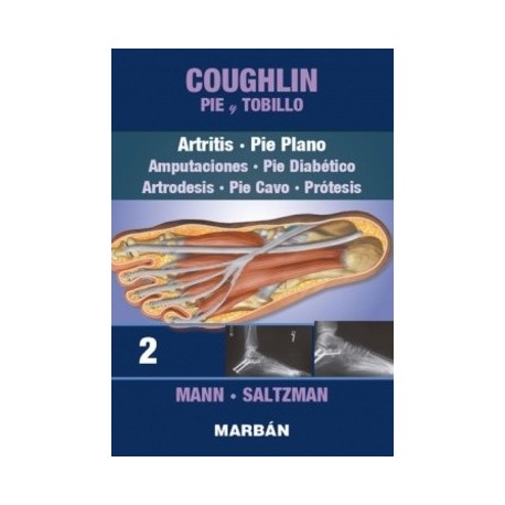 COUGHLIN PIE Y TOBILLO (TOMO 2) ARTRITIS. PIE PLANO. AMPUTACIONES. PIE DIABETICO. ARTRODESIS. PIE CAVO. PROTESIS