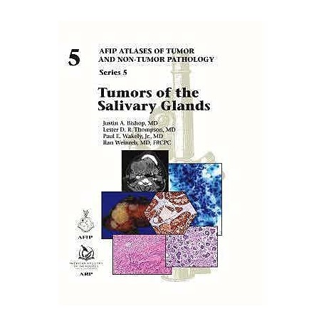 TUMORS OF THE SALIVARY GLANDS (AFIP ATLASES OF TUMOR AND NON-TUMOR PATHOLOGY SERIES 5 - VOL. 5)