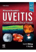 WHITCUP AND NUSSENBLAT.S UVEITIS. FUNDAMENTALS AND CLINICAL PRACTICE (DIGITAL VERSION INCLUDED)