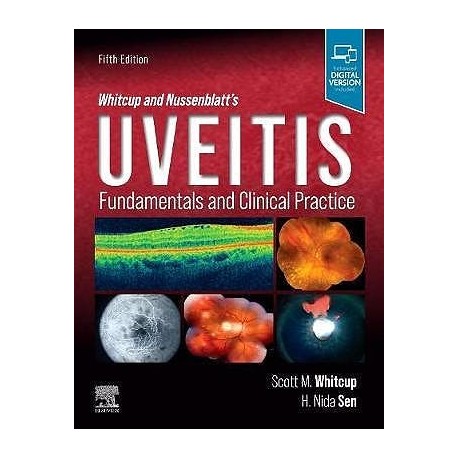 WHITCUP AND NUSSENBLAT.S UVEITIS. FUNDAMENTALS AND CLINICAL PRACTICE (DIGITAL VERSION INCLUDED)