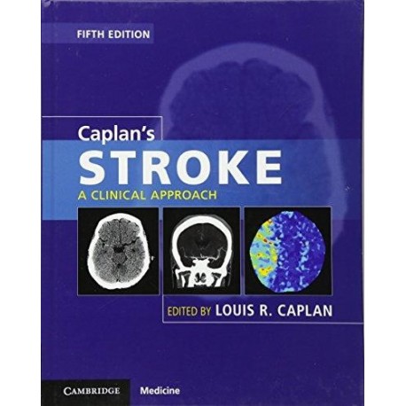 CAPLAN'S STROKE. A CLINICAL APPROACH