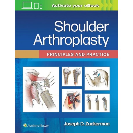 SHOULDER ARTHROPLASTY. PRINCIPLES AND PRACTICE