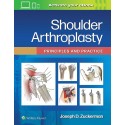 SHOULDER ARTHROPLASTY. PRINCIPLES AND PRACTICE