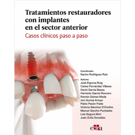 TRATAMIENTOS RESTAURADORES CON IMPLANTES EN EL SECTOR ANTERIOR. CASOS CLINICOS PASO A PASO