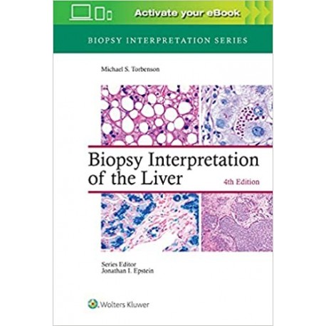 BIOPSY INTERPRETATION OF THE LIVER