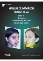 MANUAL DE ORTOPEDIA DENTOFACIAL. TOMO III. SINDROMES TRASVERSALES Y VERTICALES. APARATOLOGIA AUXILIAR