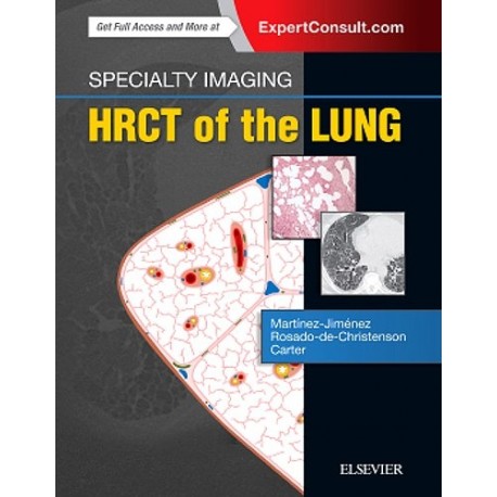 SPECIALTY IMAGING. HRCT OF THE LUNG (ONLINE AND PRINT)