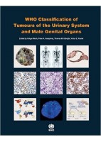 WHO CLASSIFICATION OF TUMOURS OF THE URINARY SYSTEM AND MALE GENITAL ORGANS