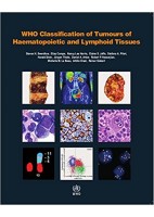 WHO CLASSIFICATION OF TUMOURS OF HAEMATOPOIETIC AND LYMPHOID TISSUES