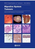 WHO CLASSIFICATION OF THE DIGESTIVE SYSTEM TUMOURS