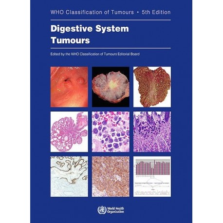 WHO CLASSIFICATION OF THE DIGESTIVE SYSTEM TUMOURS