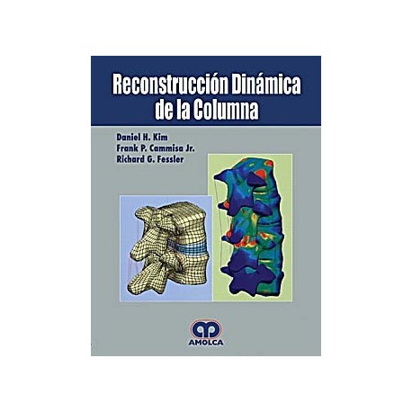 RECONSTRUCCION DINAMICA DE LA COLUMNA