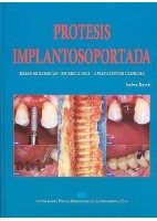 PROTESIS IMPLANTOSOPORTADA