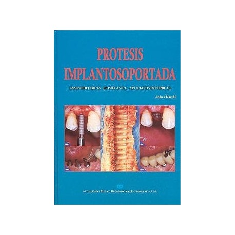 PROTESIS IMPLANTOSOPORTADA