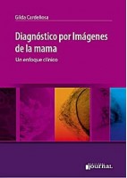 DIAGNOSTICO POR IMAGENES DE LA MAMA