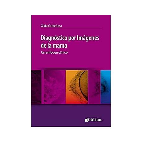 DIAGNOSTICO POR IMAGENES DE LA MAMA