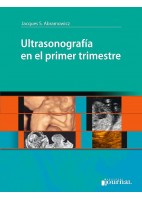 ULTRASONOGRAFIA EN EL PRIMER TRIMESTRE