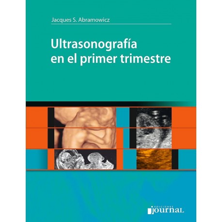 ULTRASONOGRAFIA EN EL PRIMER TRIMESTRE