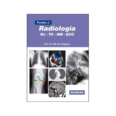 POCKET DE RADIOLOGIA. RX, TC, RM, ECO