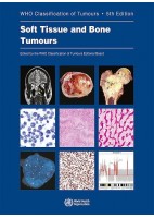 WHO CLASSIFICATION OF TUMOURS: SOFT TISSUE AND BONE TUMOURS