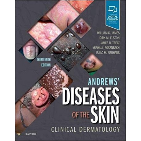 ANDREWS DISEASES OF THE SKIN (DIGITAL VERSION INCLUDED)