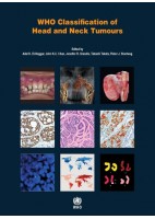 WHO CLASSIFICATION OF HEAD AND NECK TUMOURS