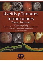 UVEITIS Y TUMORES INTRAOCULARES