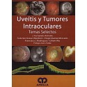UVEITIS Y TUMORES INTRAOCULARES