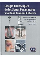 CIRUGIA ENDOSCOPICA DE LOS SENOS PARANASALES Y LA BASE CRANEAL ANTERIOR