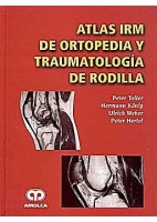 ATLAS IRM DE ORTOPEDIA Y TRAUMATOLOGIA DE RODILLA