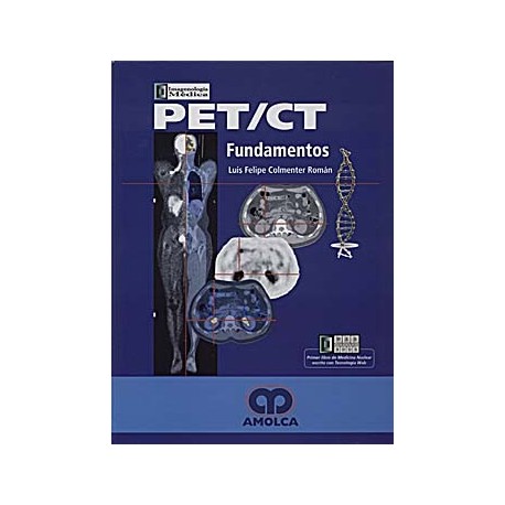 PET/CT FUNDAMENTOS