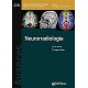 AVANCES EN DIAGNOSTICO POR IMAGENES 4: NEURORRADIOLOGIA