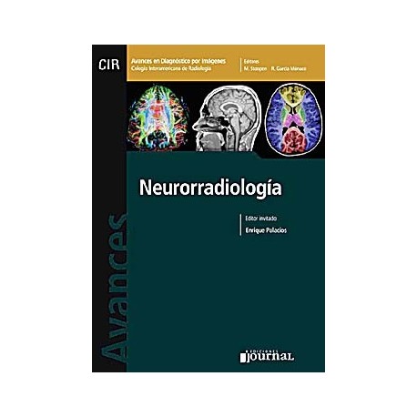 AVANCES EN DIAGNOSTICO POR IMAGENES 4: NEURORRADIOLOGIA