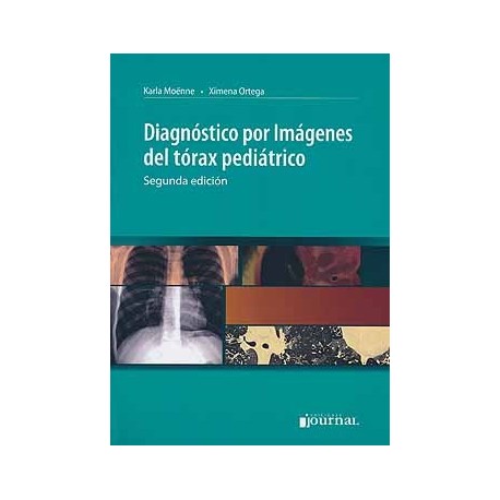 DIAGNOSTICO POR IMAGENES DEL TORAX PEDIATRICO