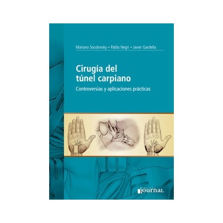 CIRUGIA DEL TUNEL CARPIANO