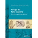 CIRUGIA DEL TUNEL CARPIANO