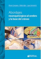 ABORDAJES NEUROQUIRURGICOS AL CEREBRO Y LA BASE DE CRANEO
